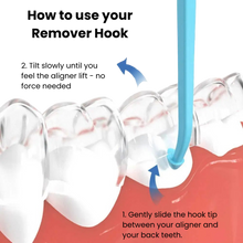 Aligner Remover Hook