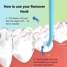 Aligner Remover Hook